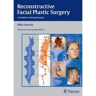 Reconstructive Facial Plastic Surgery - Weerda, Hilko