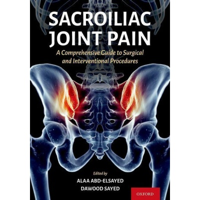 Sacroiliac Joint Pain
