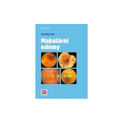 Makulární edémy - Jan Ernest