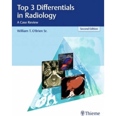Top 3 Differentials in Radiology