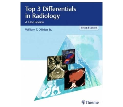 Top 3 Differentials in Radiology