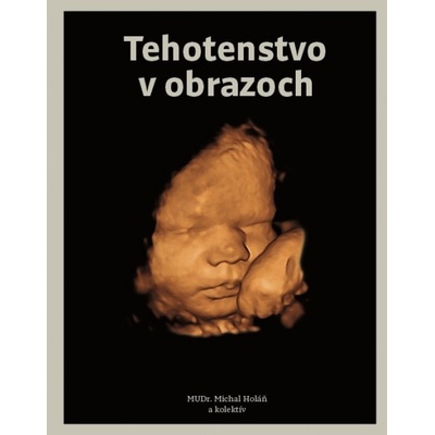 Tehotenstvo v obrazoch - Michal Holáň a kolektív