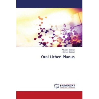 Oral Lichen Planus Attiuddin Siddiqui,Shireen Siddiqui