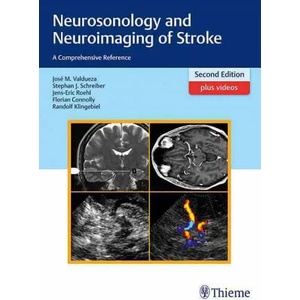 Neurosonology and Neuroimaging of Stroke | José Manuel Valdueza, Stephan Schreiber, Jens-Eric Röhl, Florian Connolly, Randolf Klingebiel (ISBN: 9783131418722)