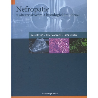 Nefropatie v ultrazvukovém a histologickém obraze - Karel Krejčí, Josef Zadražil, Tomáš Tichý
