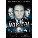Normal DVD