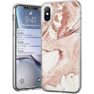 Pouzdro Wozinsky Marble Xiaomi Redmi Note 10 Xiaomi Redmi Note 10 Pro růžové