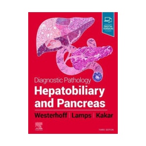 Diagnostic Pathology : Hepatobiliary and Pancreas | Laura W. Lamps (ISBN: 9780323776202)