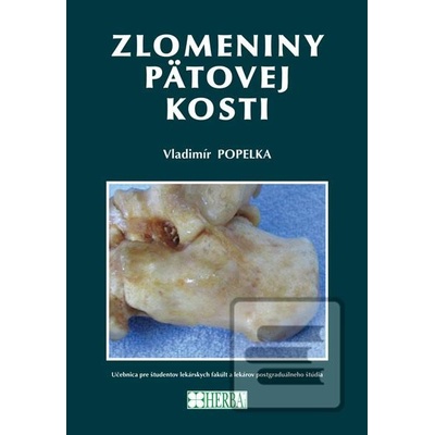 Zlomeniny pätovej kosti