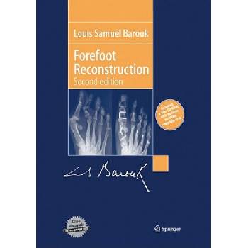 Forefoot Reconstruction | Louis S. Barouk