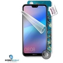 Ochranná fólie Screenshield HUAWEI P20 - displej