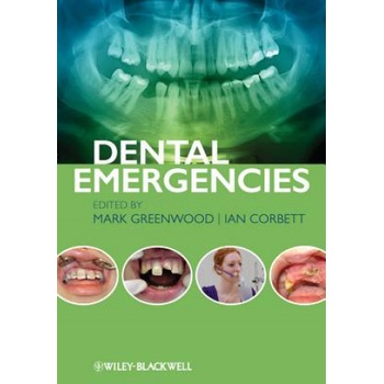 Dental Emergencies