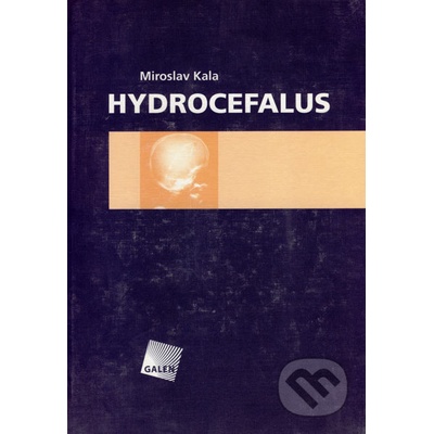 Hydrocefalus
