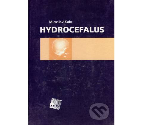 Hydrocefalus