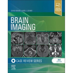 Brain Imaging | Laurie Loevner (ISBN: 9781455774852)