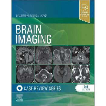 Image 1 of Brain Imaging | Laurie Loevner