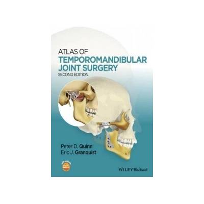 Atlas of Temporomandibular Joint Surgery