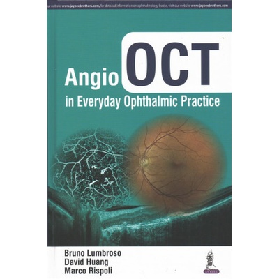 Angio OCT in Everyday Ophthalmic Practice Lumbroso Bruno