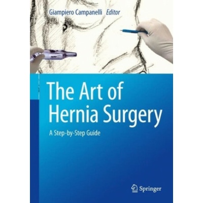 Art of Hernia Surgery