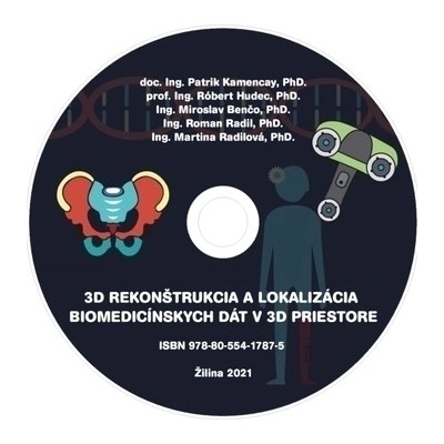CD - 3D rekonštrukcia a lokalizácia biomedicínskych dát v 3D priestore