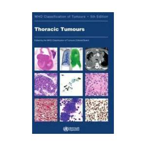 Thoracic Tumours: Who Classification of Tumours | WHO Classification of Tumours Editorial Board (ISBN: 9789283245063)