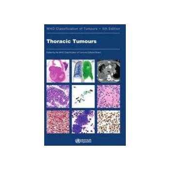 Image 1 of Thoracic Tumours: Who Classification of Tumours