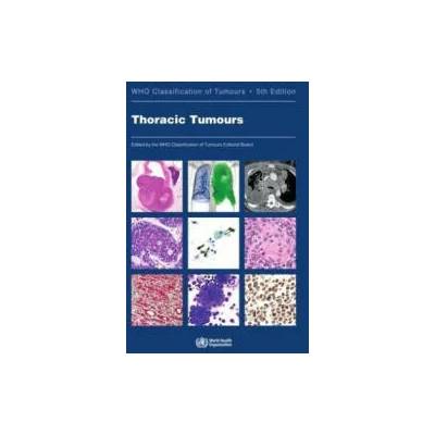Thoracic Tumours: Who Classification of Tumours