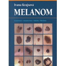 Melanom