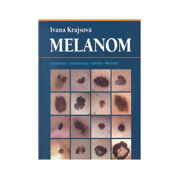 Melanom