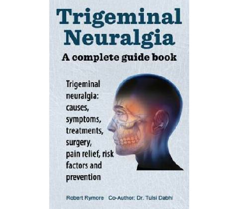 Trigeminal Neuralgia