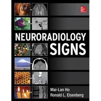 Neuroradiology Signs - Ho Mai-Lan
