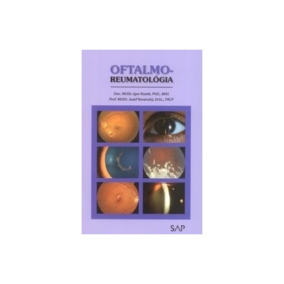 Oftalmo-reumatológia