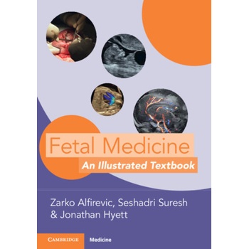 Fetal Medicine