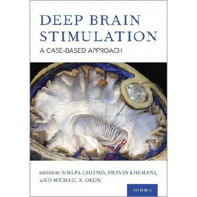 Deep Brain Stimulation