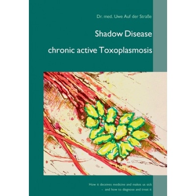 Shadow Disease chronic active Toxoplasmosis