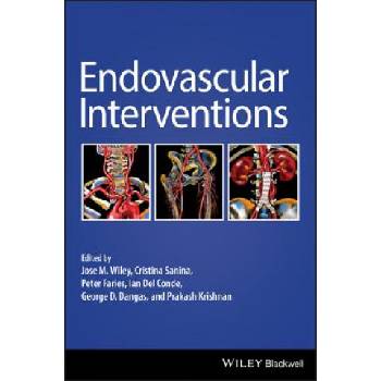Endovascular Interventions | JOSE WILEY