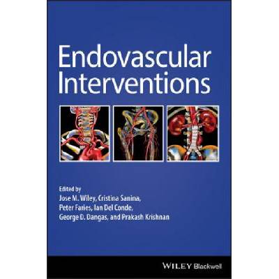 Endovascular Interventions | JOSE WILEY