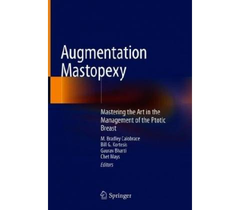 Augmentation Mastopexy