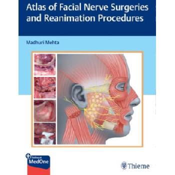 Image 1 of Atlas of Facial Nerve Surgeries and Reanimation Procedures | Madhuri Mehta
