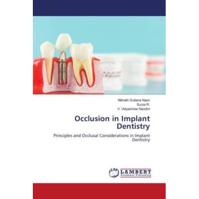 Occlusion in Implant Dentistry Surya R.,V. Vidyashree Nandini