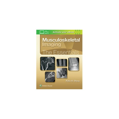 Musculoskeletal Imaging: The Essentials Chew Felix S. Pevná vazba