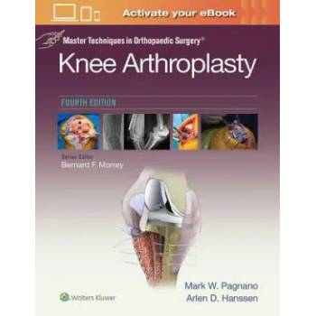 Image 1 of Master Techniques in Orthopedic Surgery: Knee Arthroplasty | Mark W. Pagnano