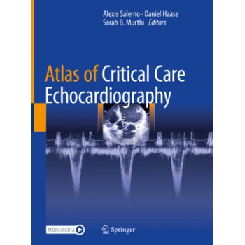 Atlas of Critical Care Echocardiography | Alexis Salerno, Daniel Haase, Sarah B. Murthi