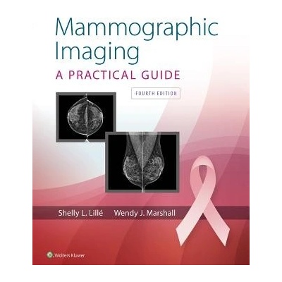 Mammographic Imaging Lille Shelly L.Pevná vazba