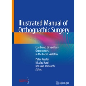 Illustrated Manual of Orthognathic Surgery | Peter Kessler, Nicolas Hardt, Kensuke Yamauchi (ISBN: 9783031735912)