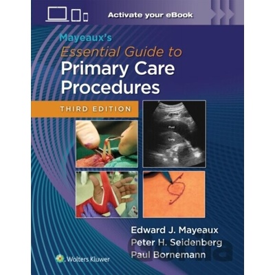 Mayeaux's Essential Guide to Primary Care Procedures: Print + eBook with Multimedia - Edward John Mayeaux, Paul Bornemann