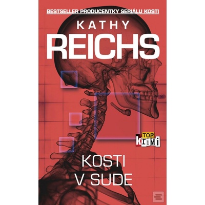 Kosti v sude