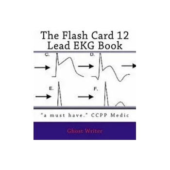 The Flash Card 12 Lead EKG