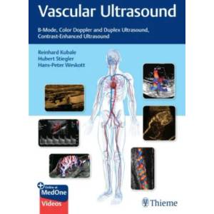 Vascular Ultrasound | Hubert Stiegler, Hans-Peter Weskott (ISBN: 9783132405431)
