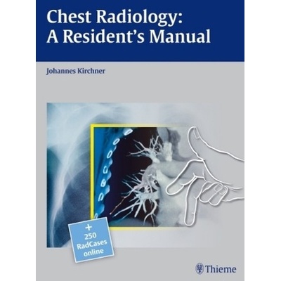 Chest Radiology - Kirchner, Johannes